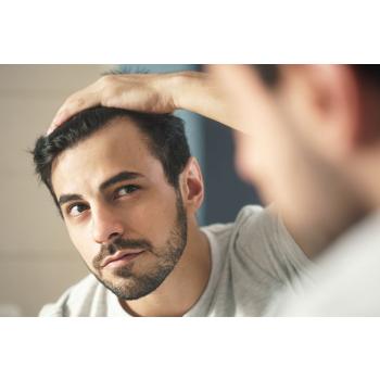 Saç Yağlanmasını Engellemek İçin Ne Yapılmalı?